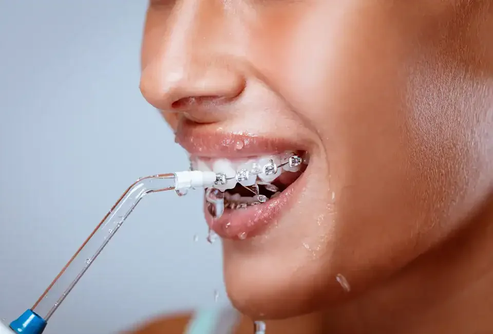 dental cleaning