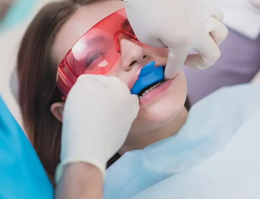 What is Fluoride Treatments
