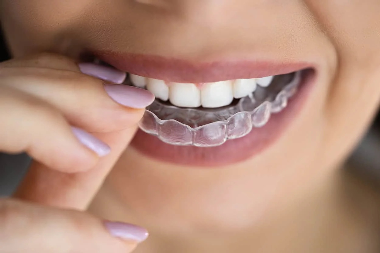 woman with snore guard