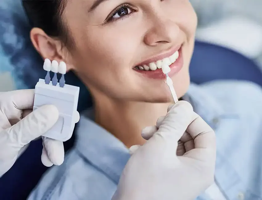What is Professional Teeth Whitening