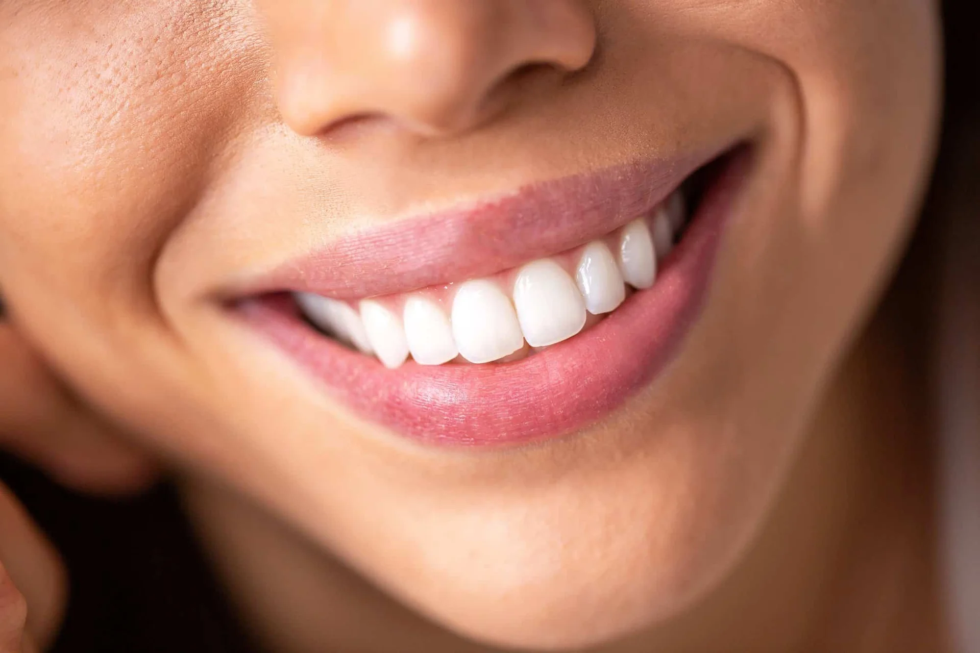 professional teeth whitening results