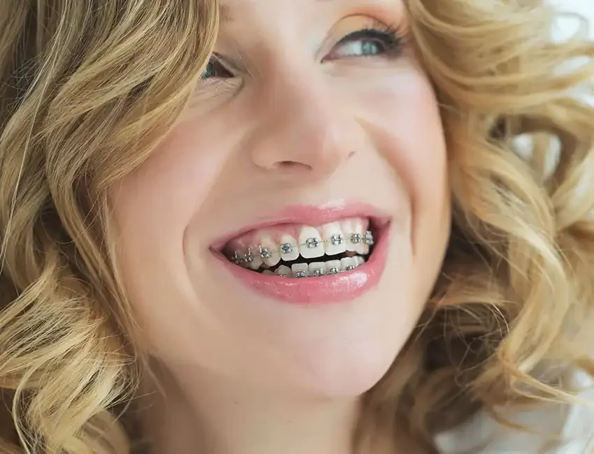 Braces at Foothill Ranch Dentistry