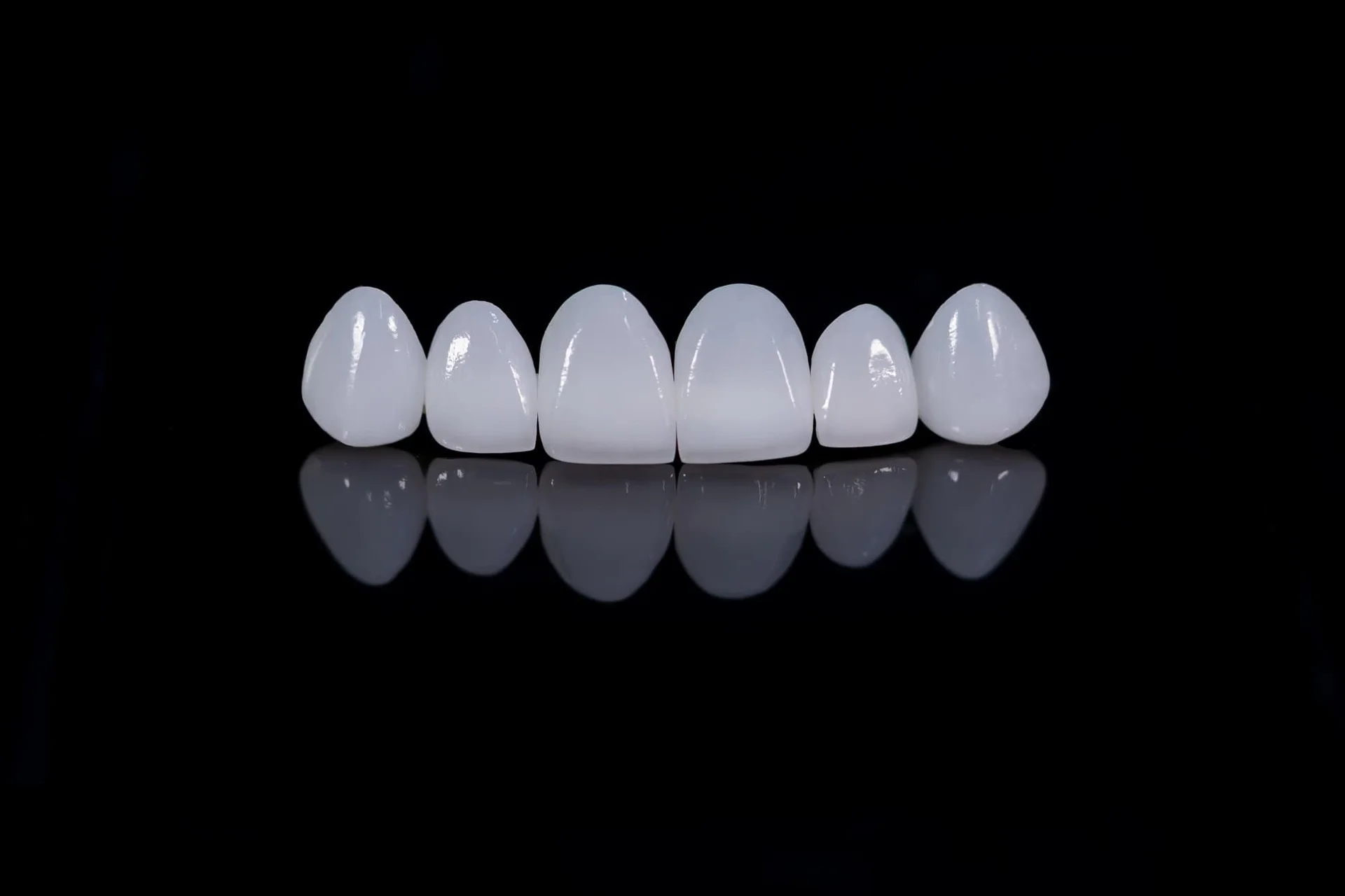 dental veneers before placement